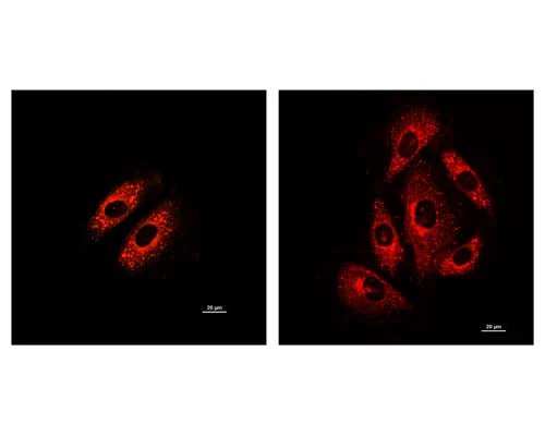 LipoFluor-P2™ Polar Lipid & Endoplasmic Reticulum Tracing Reagent