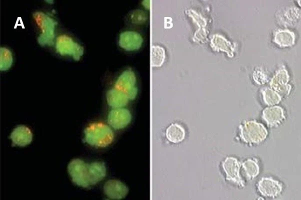 Magic Red® Fluorescent Cathepsin K Assay Kit - Image 4