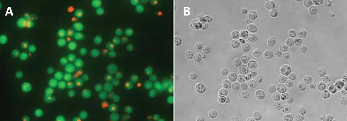 Necrosis vs Apoptosis Assay Kit - Image 3