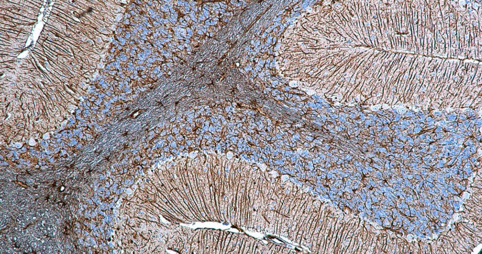 Streptavidin/Biotin-ABC-Peroxidase Staining Kit - Image 3