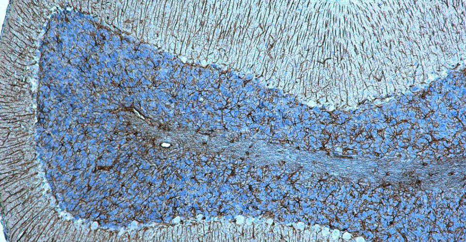 Streptavidin/Biotin-ABC-Peroxidase Staining Kit - Image 4